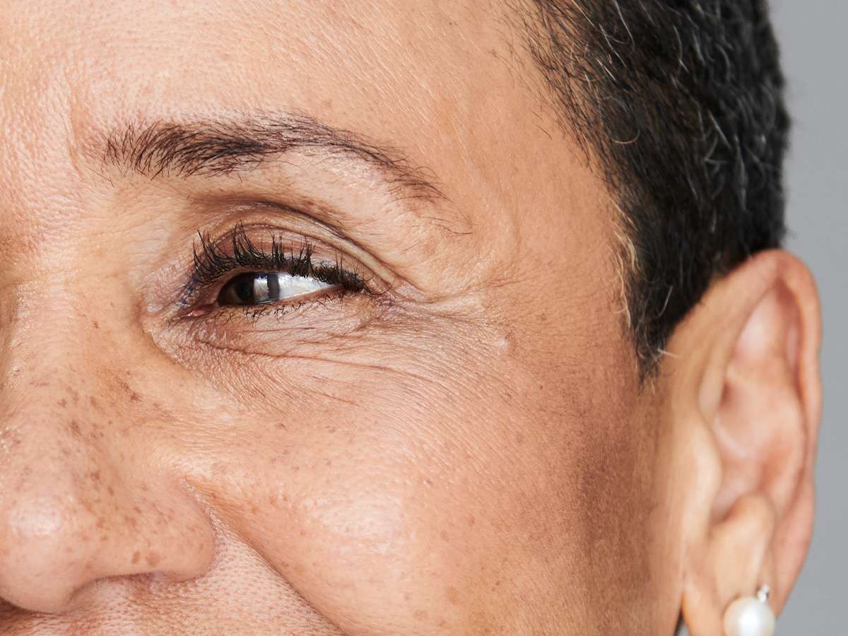 Wrinkles