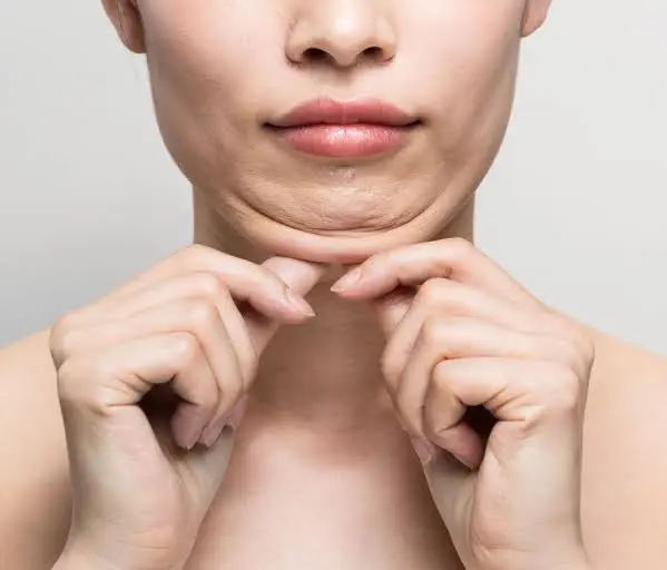 Slow results from diet and exercise alone